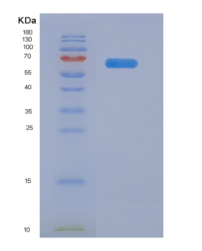 SDS-PAGE analysis of Human ADAM12 (Disintegrin And Metalloproteinase Domain-Containing Protein 12) - Recombinant Protein, showing >85% purity under 15% SDS-PAGE (Reduced)