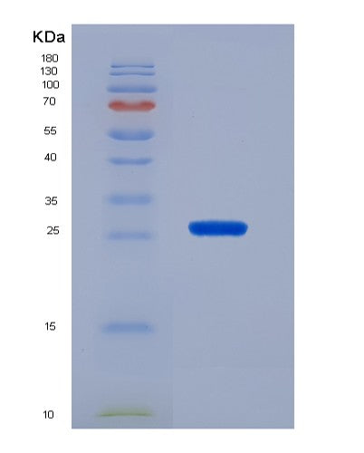 SDS-PAGE analysis of Human FOXA1 (Hepatocyte Nuclear Factor 3-Alpha) - Recombinant Protein, showing >90% purity under 15% SDS-PAGE (Reduced)
