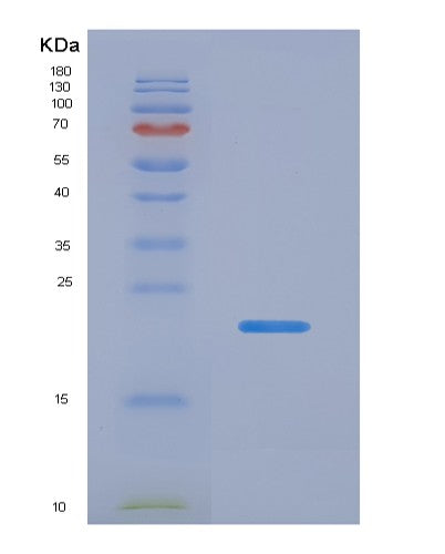 SDS-PAGE analysis of Human EEF1E1 (Eukaryotic Translation Elongation Factor 1 Epsilon-1) - Recombinant Protein, showing >90% purity under 15% SDS-PAGE (Reduced)