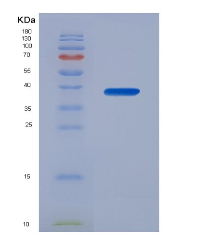 SDS-PAGE analysis of Human KLF4 (Krueppel-Like Factor 4) - Recombinant Protein, showing >95% purity under 15% SDS-PAGE (Reduced)