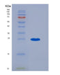 SDS-PAGE analysis of Human LAT (Linker For Activation Of T-Cells Family Member 1) - Recombinant Protein, showing >90% purity under 15% SDS-PAGE (Reduced)