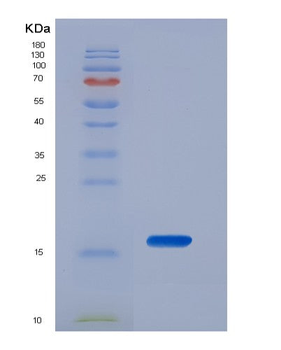 SDS-PAGE analysis of Mouse Vipr1 (Vasoactive Intestinal Polypeptide Receptor 1) - Recombinant Protein, showing >90% purity under 15% SDS-PAGE (Reduced)