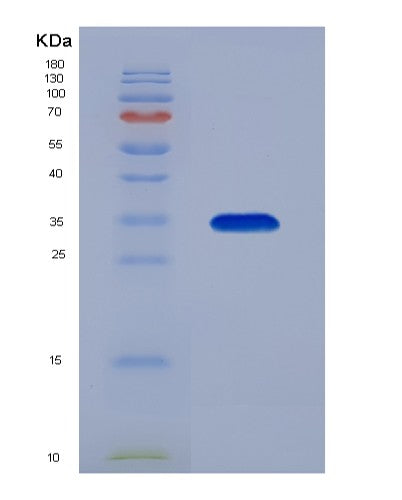 SDS-PAGE analysis of Human P2RX7 (P2X Purinoceptor 7) - Recombinant Protein, showing >90% purity under 15% SDS-PAGE (Reduced)