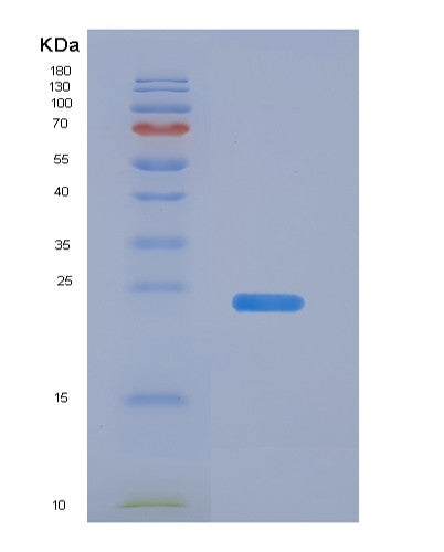 SDS-PAGE analysis of Human Interleukin 6 (IL6) - Recombinant Protein, CAT# BLT-08451P showing >90% purity under 15% SDS-PAGE (Reduced)