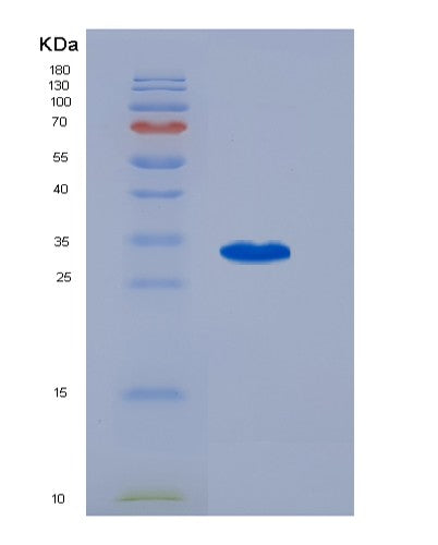 SDS-PAGE analysis of Human RORA (Nuclear Receptor Ror-Alpha) - Recombinant Protein, showing >90% purity under 15% SDS-PAGE (Reduced)