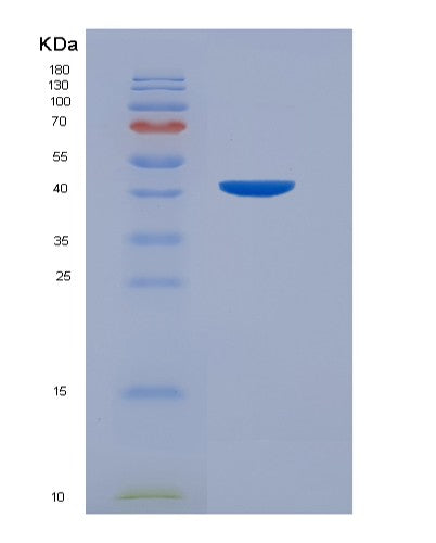 SDS-PAGE analysis of Human NARS1 (Asparagine--Trna Ligase, Cytoplasmic) - Recombinant Protein, showing >90% purity under 15% SDS-PAGE (Reduced)
