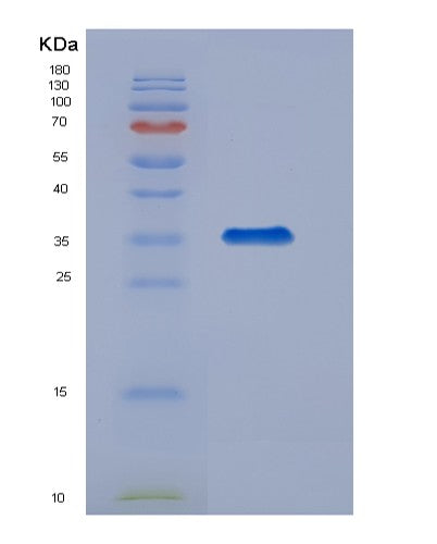 SDS-PAGE analysis of Mouse Tfpi (Tissue Factor Pathway Inhibitor) - Recombinant Protein, showing >90% purity under 15% SDS-PAGE (Reduced)