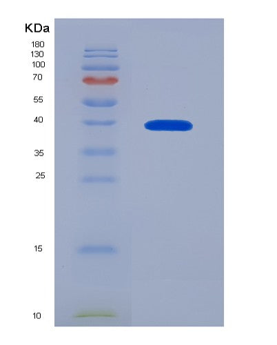 SDS-PAGE analysis of Human AKR1B10 (Aldo-Keto Reductase Family 1 Member B10) - Recombinant Protein, showing >90% purity under 15% SDS-PAGE (Reduced)