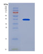 SDS-PAGE analysis of Human AKR1B10 (Aldo-Keto Reductase Family 1 Member B10) - Recombinant Protein, showing >90% purity under 15% SDS-PAGE (Reduced)