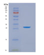 SDS-PAGE analysis of Mouse Nnmt (Nicotinamide N-Methyltransferase) - Recombinant Protein, showing >90% purity under 15% SDS-PAGE (Reduced)