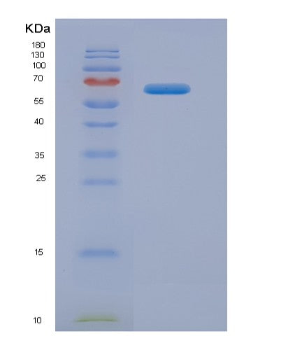 SDS-PAGE analysis of Human LAMB2 (Laminin Subunit Beta-2) - Recombinant Protein, showing >90% purity under 15% SDS-PAGE (Reduced)