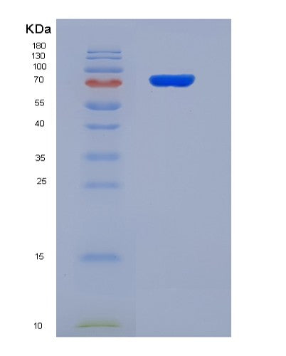 SDS-PAGE analysis of Human GSN (Gelsolin) - Recombinant Protein, showing >90% purity under 15% SDS-PAGE (Reduced)