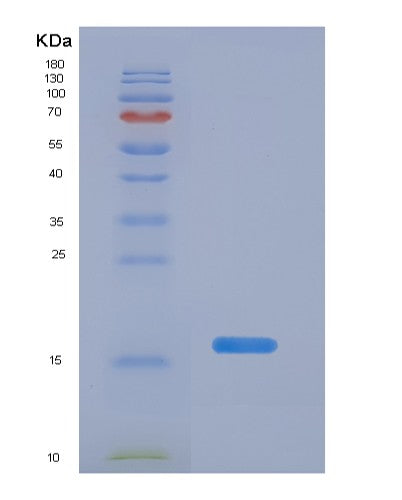 SDS-PAGE analysis of Human MUC5B (Mucin-5B) - Recombinant Protein, showing >90% purity under 15% SDS-PAGE (Reduced)
