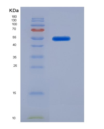 SDS-PAGE analysis of Human GAS7 (Growth Arrest-Specific Protein 7) - Recombinant Protein, showing >85% purity under 15% SDS-PAGE (Reduced)