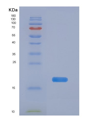SDS-PAGE analysis of Human PFDN1 (Prefoldin Subunit 1) - Recombinant Protein, showing >90% purity under 15% SDS-PAGE (Reduced)