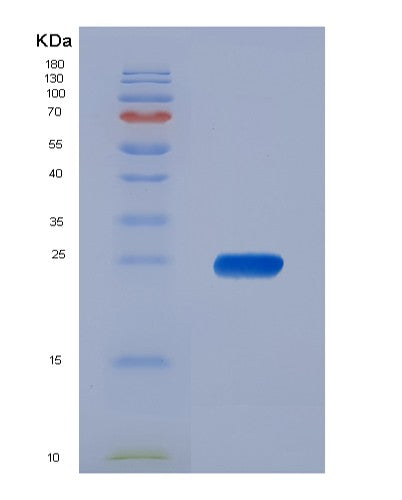 SDS-PAGE analysis of Human PPP1R11 (E3 Ubiquitin-Protein Ligase Ppp1R11) - Recombinant Protein, showing >95% purity under 15% SDS-PAGE (Reduced)