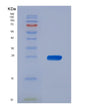 SDS-PAGE analysis of Human PPP1R11 (E3 Ubiquitin-Protein Ligase Ppp1R11) - Recombinant Protein, showing >95% purity under 15% SDS-PAGE (Reduced)