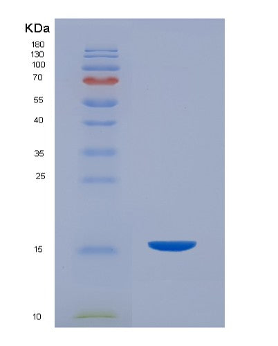 SDS-PAGE analysis of Mouse Pigr (Polymeric Immunoglobulin Receptor) - Recombinant Protein, showing >90% purity under 15% SDS-PAGE (Reduced)