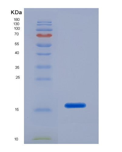 SDS-PAGE analysis of Human POSTN (Periostin) - Recombinant Protein, showing >90% purity under 15% SDS-PAGE (Reduced)