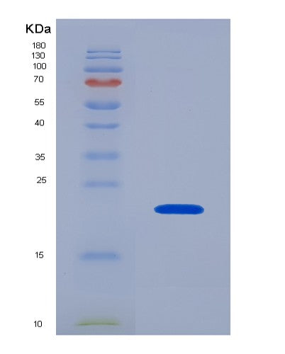 SDS-PAGE analysis of Human PROS1 (Vitamin K-Dependent Protein S) - Recombinant Protein, showing >90% purity under 15% SDS-PAGE (Reduced)