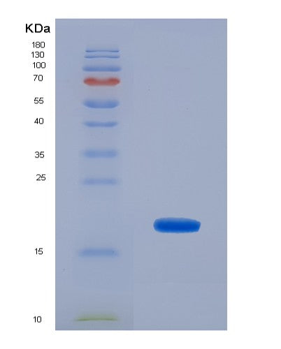 SDS-PAGE analysis of Human TBCA (Tubulin-Specific Chaperone A) - Recombinant Protein, showing >90% purity under 15% SDS-PAGE (Reduced)