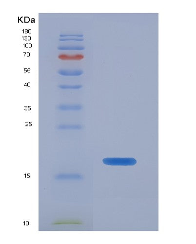 SDS-PAGE analysis of Human ECRG4 (Augurin) - Recombinant Protein, showing >90% purity under 15% SDS-PAGE (Reduced)