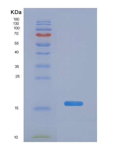 SDS-PAGE analysis of Human PPARG (Peroxisome Proliferator-Activated Receptor Gamma) - Recombinant Protein, showing >90% purity under 15% SDS-PAGE (Reduced)