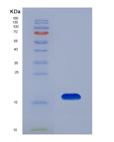 SDS-PAGE analysis of Human PPARA (Peroxisome Proliferator-Activated Receptor Alpha) - Recombinant Protein, showing >90% purity under 15% SDS-PAGE (Reduced)