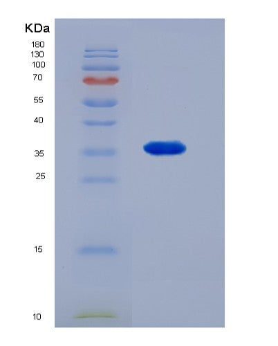 SDS-PAGE analysis of Human CS (Citrate Synthase, Mitochondrial) - Recombinant Protein, showing >95% purity under 15% SDS-PAGE (Reduced)