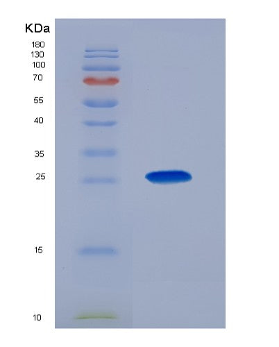SDS-PAGE analysis of Human PSIP1 (Pc4 And Sfrs1-Interacting Protein) - Recombinant Protein, showing >90% purity under 15% SDS-PAGE (Reduced)