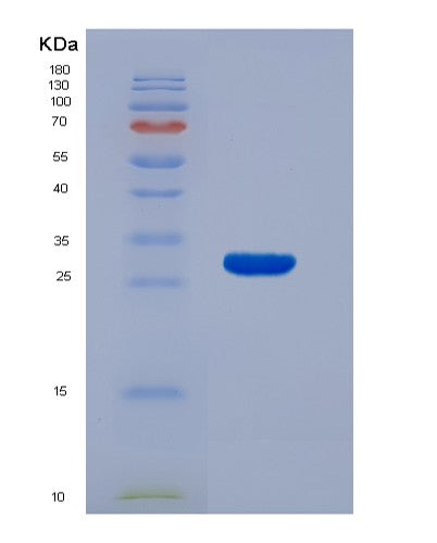 SDS-PAGE analysis of Human ECI2 (Enoyl-Coa Delta Isomerase 2) - Recombinant Protein, showing >95% purity under 15% SDS-PAGE (Reduced)