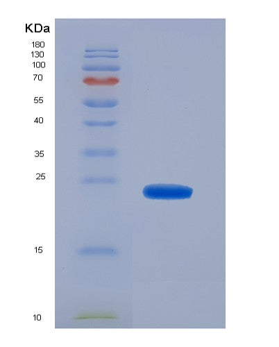 SDS-PAGE analysis of Human CD8A (T-Cell Surface Glycoprotein Cd8 Alpha Chain) - Recombinant Protein, showing >90% purity under 15% SDS-PAGE (Reduced)