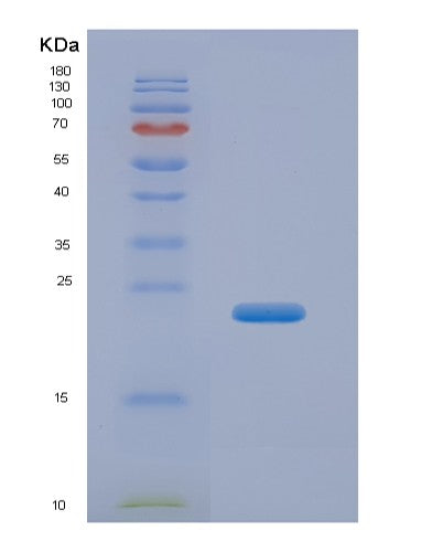 SDS-PAGE analysis of Human GCAT (2-Amino-3-Ketobutyrate Coenzyme A Ligase, Mitochondrial) - Recombinant Protein, showing >85% purity under 15% SDS-PAGE (Reduced)