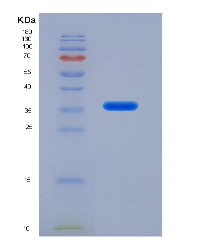 SDS-PAGE analysis of Human RNASEH2A (Ribonuclease H2 Subunit A) - Recombinant Protein, showing >90% purity under 15% SDS-PAGE (Reduced)