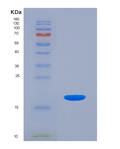 SDS-PAGE analysis of Human CDC123 (Translation Initiation Factor Eif2 Assembly Protein) - Recombinant Protein, showing >90% purity under 15% SDS-PAGE (Reduced)
