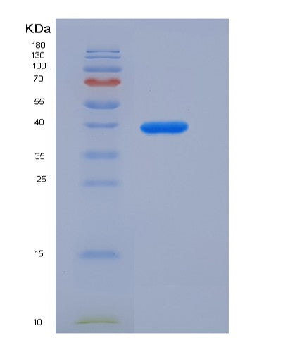 SDS-PAGE analysis of Human CBR3 (Carbonyl Reductase [Nadph] 3) - Recombinant Protein, showing >95% purity under 15% SDS-PAGE (Reduced)