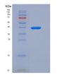 SDS-PAGE analysis of Human CBR3 (Carbonyl Reductase [Nadph] 3) - Recombinant Protein, showing >95% purity under 15% SDS-PAGE (Reduced)