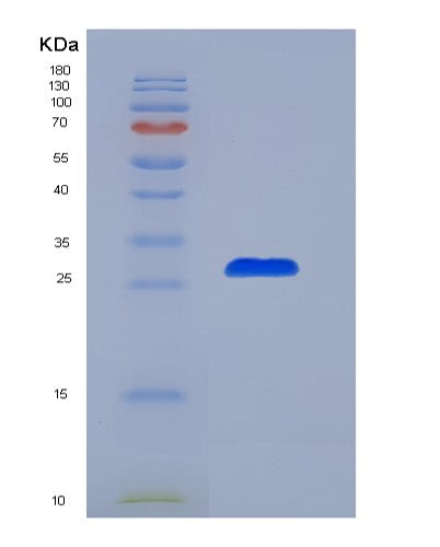 SDS-PAGE analysis of Human PSMD10 (26S Proteasome Non-Atpase Regulatory Subunit 10) - Recombinant Protein, showing >90% purity under 15% SDS-PAGE (Reduced)