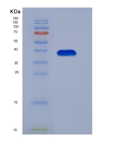 SDS-PAGE analysis of Human MMP23B (Matrix Metalloproteinase-23) - Recombinant Protein, showing >90% purity under 15% SDS-PAGE (Reduced)