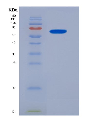 SDS-PAGE analysis of Human BEST1 (Bestrophin-1) - Recombinant Protein, showing >85% purity under 15% SDS-PAGE (Reduced)