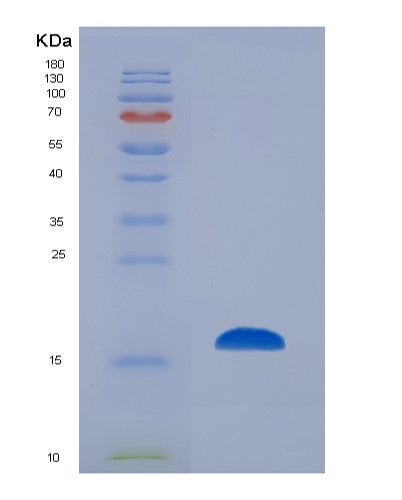 SDS-PAGE analysis of Mouse Cd83 (Cd83 Antigen) - Recombinant Protein, showing >90% purity under 15% SDS-PAGE (Reduced)