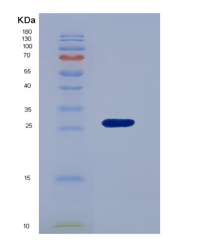 SDS-PAGE analysis of Human DDAH1 (N(G),N(G)-Dimethylarginine Dimethylaminohydrolase 1) - Recombinant Protein, showing >85% purity under 15% SDS-PAGE (Reduced)