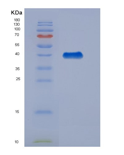 SDS-PAGE analysis of Human Creatine Kinase M+B (CKMB) - Recombinant Protein, showing >90% purity under 15% SDS-PAGE (Reduced)