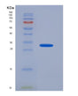SDS-PAGE analysis of Human DKK1 (Dickkopf-Related Protein 1) - Recombinant Protein, showing >95% purity under 15% SDS-PAGE (Reduced)