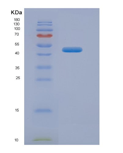 SDS-PAGE analysis of Human SNUPN (Snurportin-1) - Recombinant Protein, showing >85% purity under 15% SDS-PAGE (Reduced)