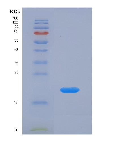 SDS-PAGE analysis of Human VAPB (Vesicle-Associated Membrane Protein-Associated Protein B/C) - Recombinant Protein, showing >90% purity under 15% SDS-PAGE (Reduced)