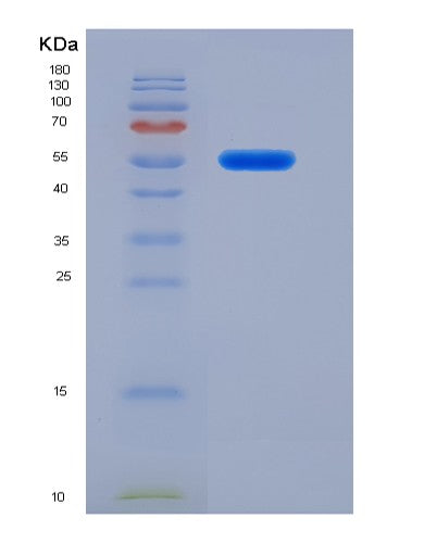 SDS-PAGE analysis of Human FARS2 (Phenylalanine--Trna Ligase, Mitochondrial) - Recombinant Protein, showing >95% purity under 15% SDS-PAGE (Reduced)