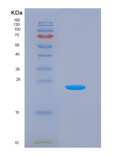 SDS-PAGE analysis of Human LYPLA2 (Acyl-Protein Thioesterase 2) - Recombinant Protein, showing >90% purity under 15% SDS-PAGE (Reduced)