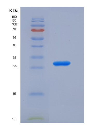 SDS-PAGE analysis of Human APOM (Apolipoprotein M) - Recombinant Protein, showing >90% purity under 15% SDS-PAGE (Reduced)