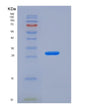 SDS-PAGE analysis of Human APOM (Apolipoprotein M) - Recombinant Protein, showing >90% purity under 15% SDS-PAGE (Reduced)